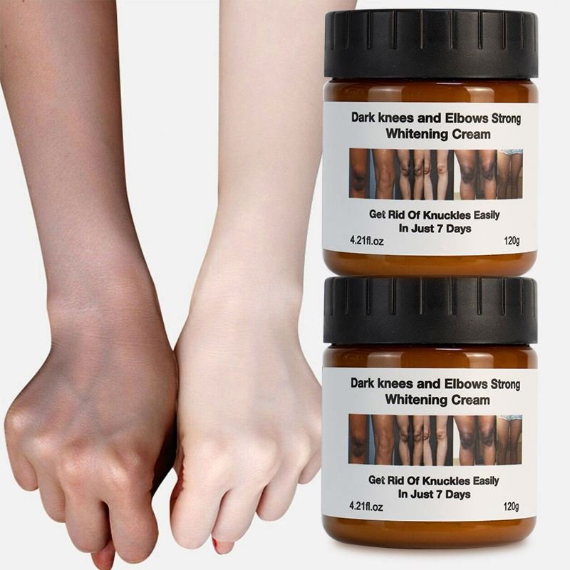 niacinamide Extreme Whitening Anti Dark Spot Aging Wrinkle Knees Elbows Strong Vitamin White Lotion Face Body Whitening Cream