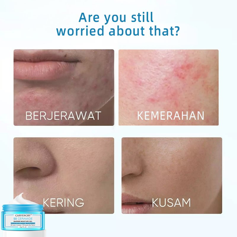 Korea skincare products 5X Ceramide Barrier moisture Cream Locks in Hydration Smooths Skin Texture Face Cream for beauty 30ml
