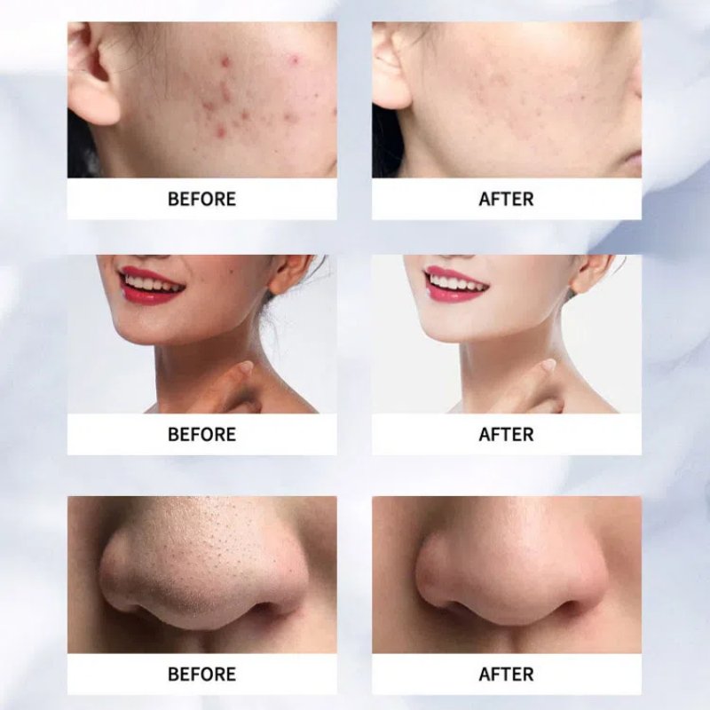 Private Label Facial Skin Wrinkle Remove Moisturizing Skin Anti-aging Face Whitening Anti-Wrinkle Repair Bosin Face Cream OEM