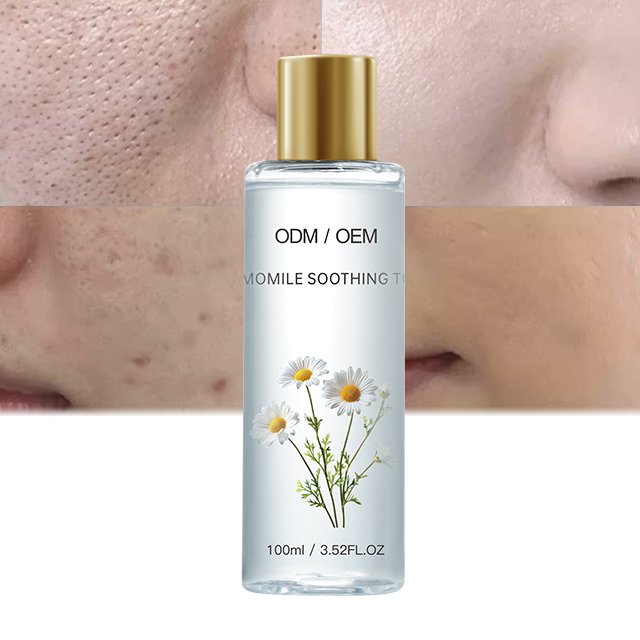 OEM Chamomile Water Moisturizing Toner Chamomile Soothing Facial Toner After-sun Repair Face Toner