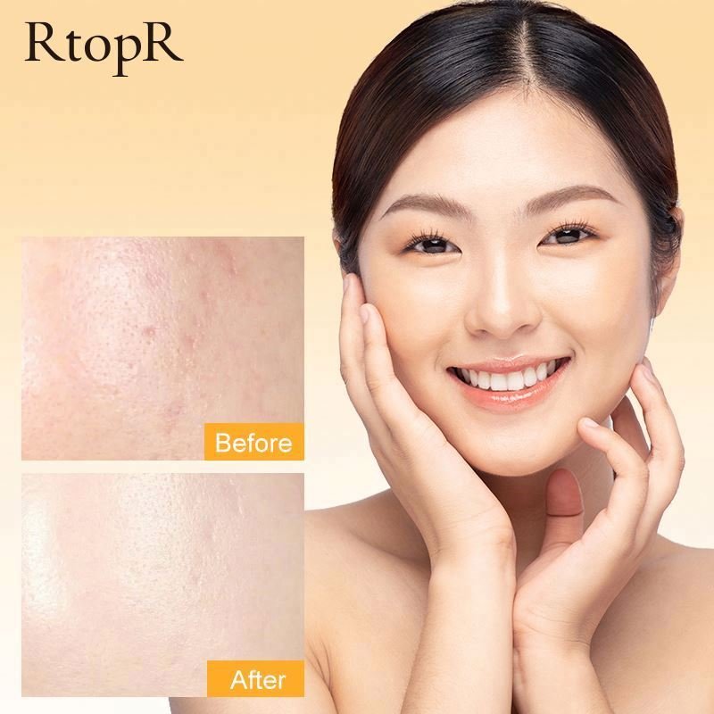 Moisturizing Face Cream RtopR Vitamin C Facial Whitening Organic Natural