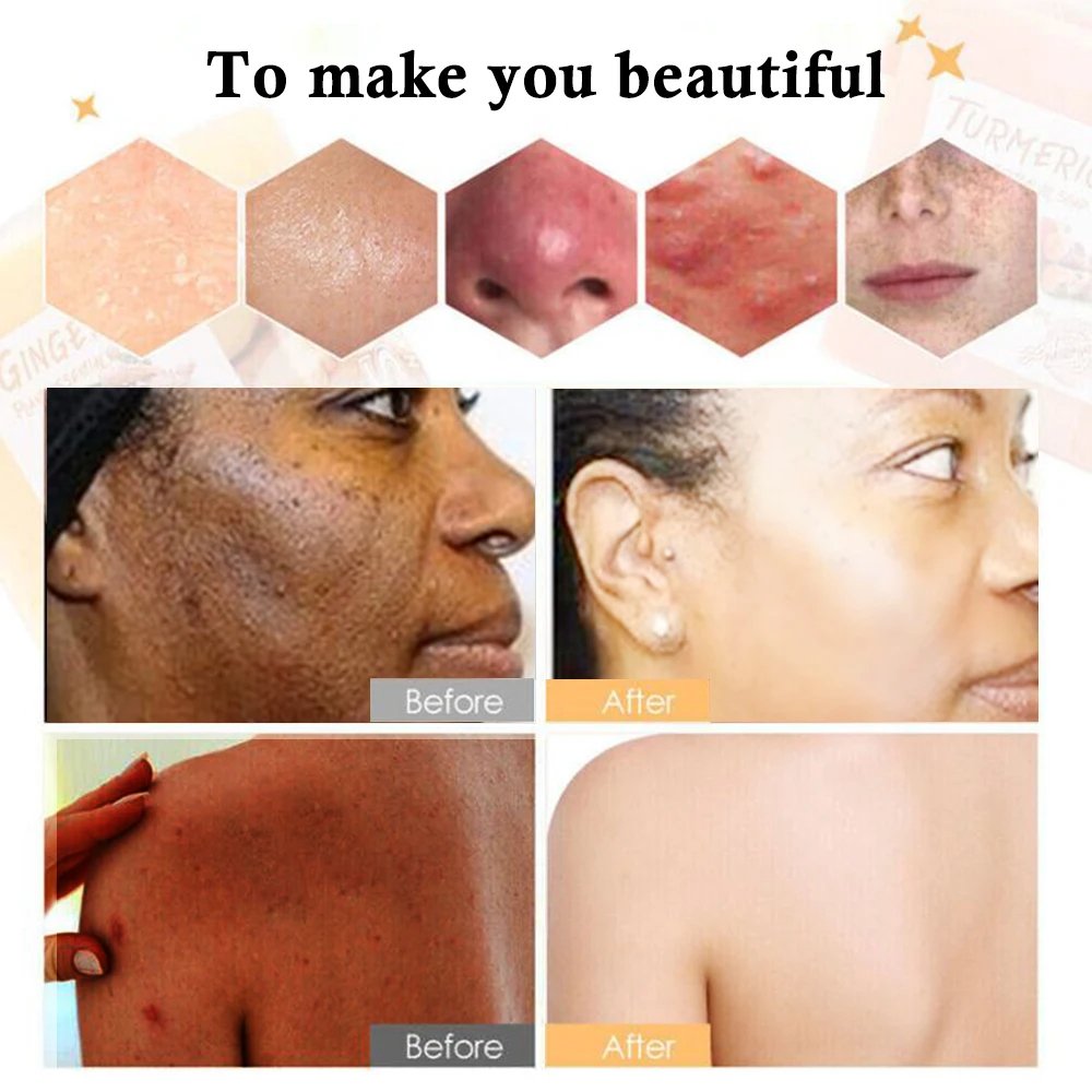 Facial cream High quality powerful brightening skin face cream moisturizing anti aging acne removing whitening facial cream