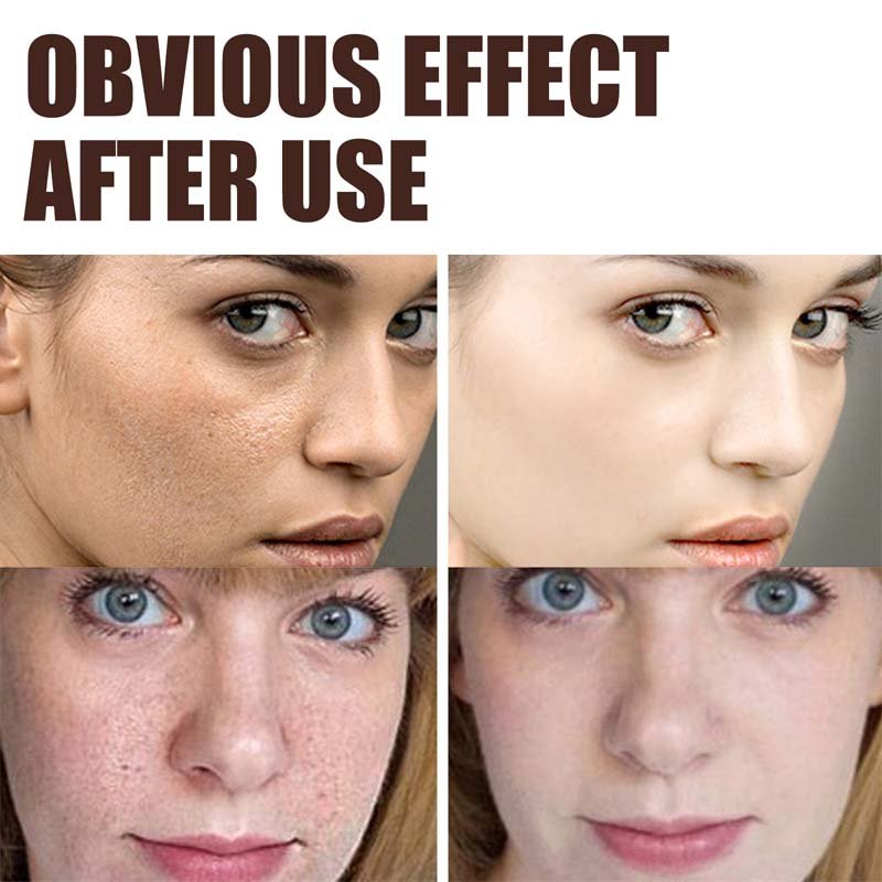 Retinol Anti Aging Face Cream Remove Wrinkle Firming Skin Care Hyaluronic Acid Moisturizing Whitening Bright Beauty Cosmetics