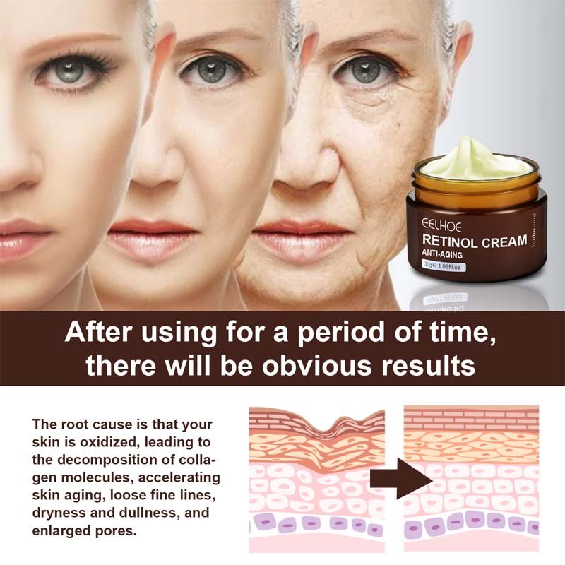 Retinol Anti Aging Face Cream Remove Wrinkle Firming Skin Care Hyaluronic Acid Moisturizing Whitening Bright Beauty Cosmetics