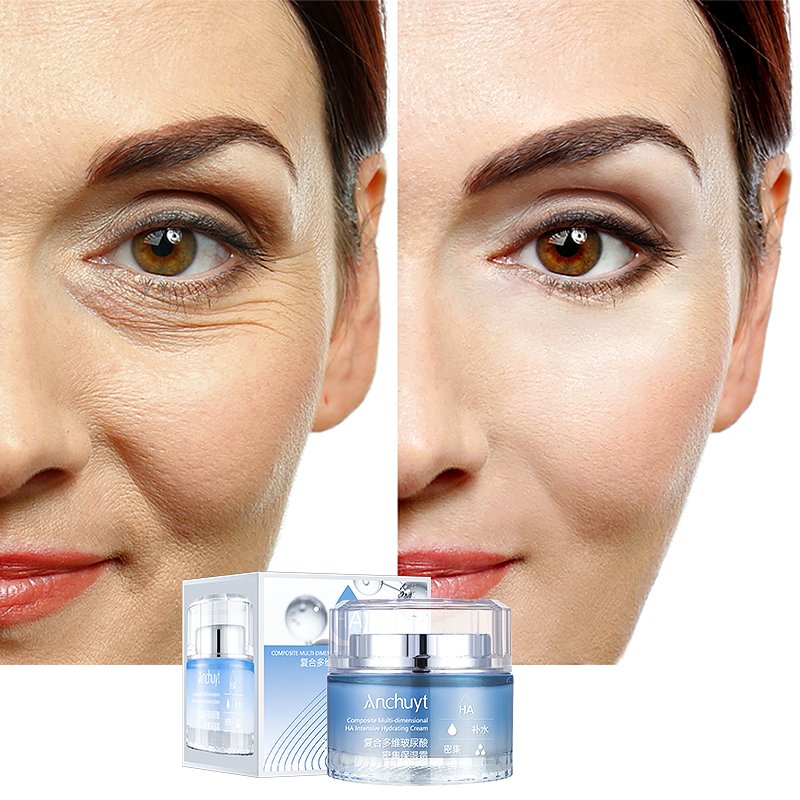 Anchuyt Natural Hyaluronic Acid Whitening Face Cream Anti Aging Firming Remove Sopts Moisturizing Whitening Face and Body Cream