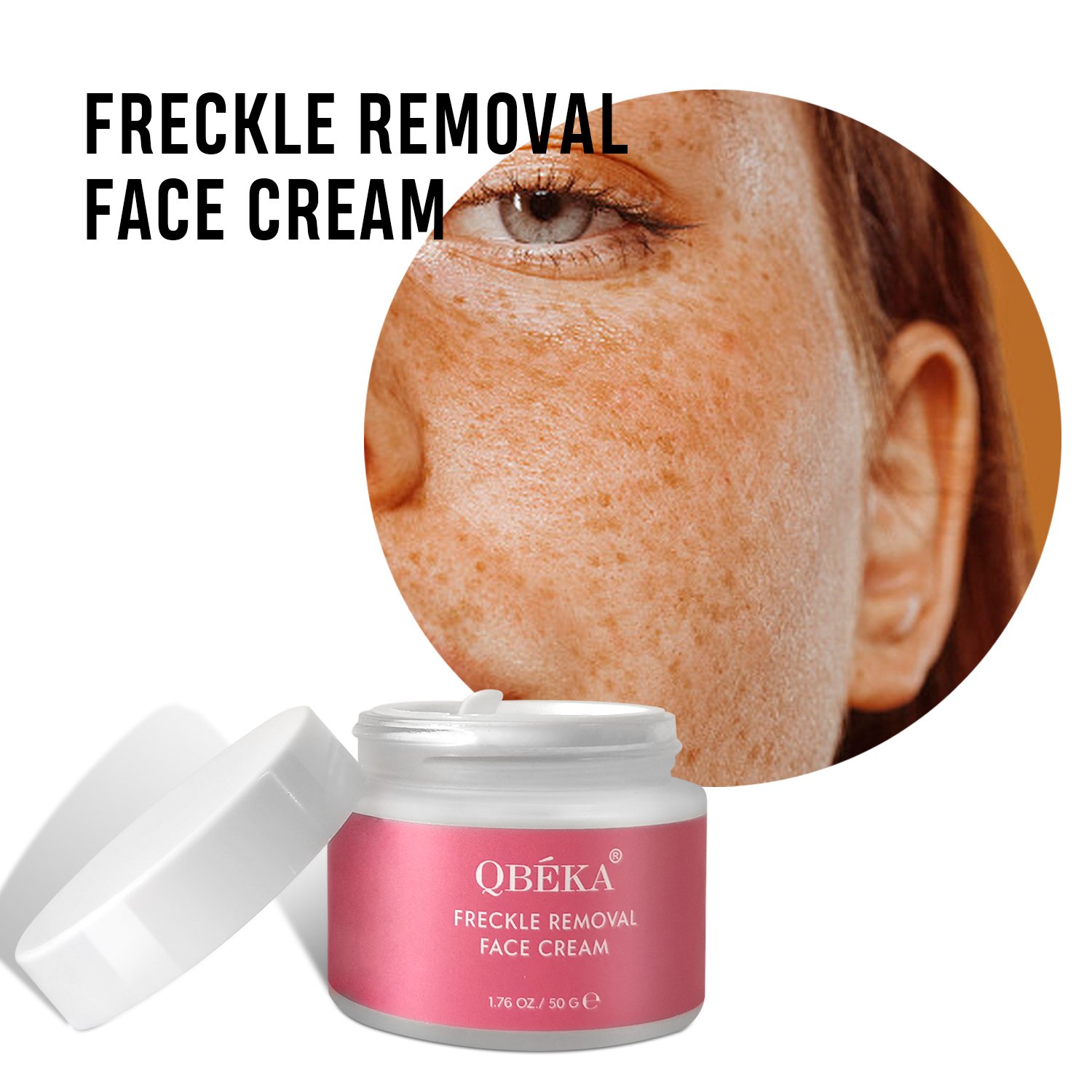 Wholesale Moisturize Skin Freckle Removal Face Cream For All Skin Tones - Melasma, Freckle, Sun Spot Remover & Blemish Reducer