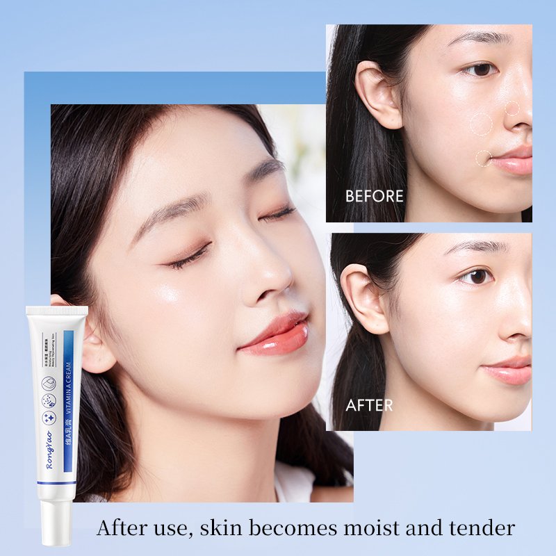 RongYao Private Label Face Cream and Lotion Moisturizing Day and Night Skin Care Set Vitamin A&E Face Cream