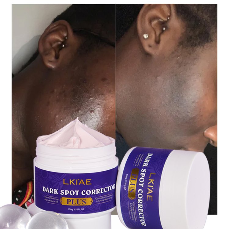 Private label Skin Repairing Face Care Remove Dark Spots anti aging anti wrinkle Face Cream for Dark Skin