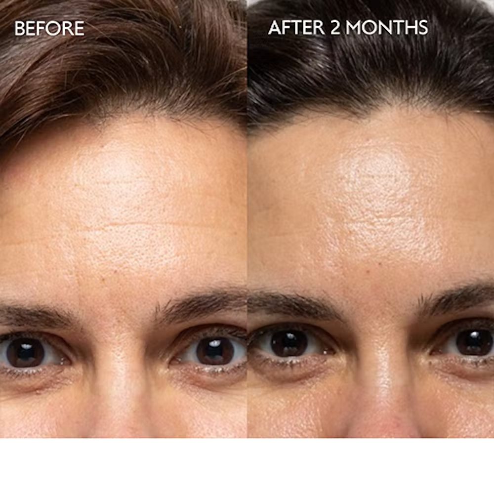 Private label new best skin care anti aging cream and wrinkles face cream moisturizer with Hyaluronic Acid