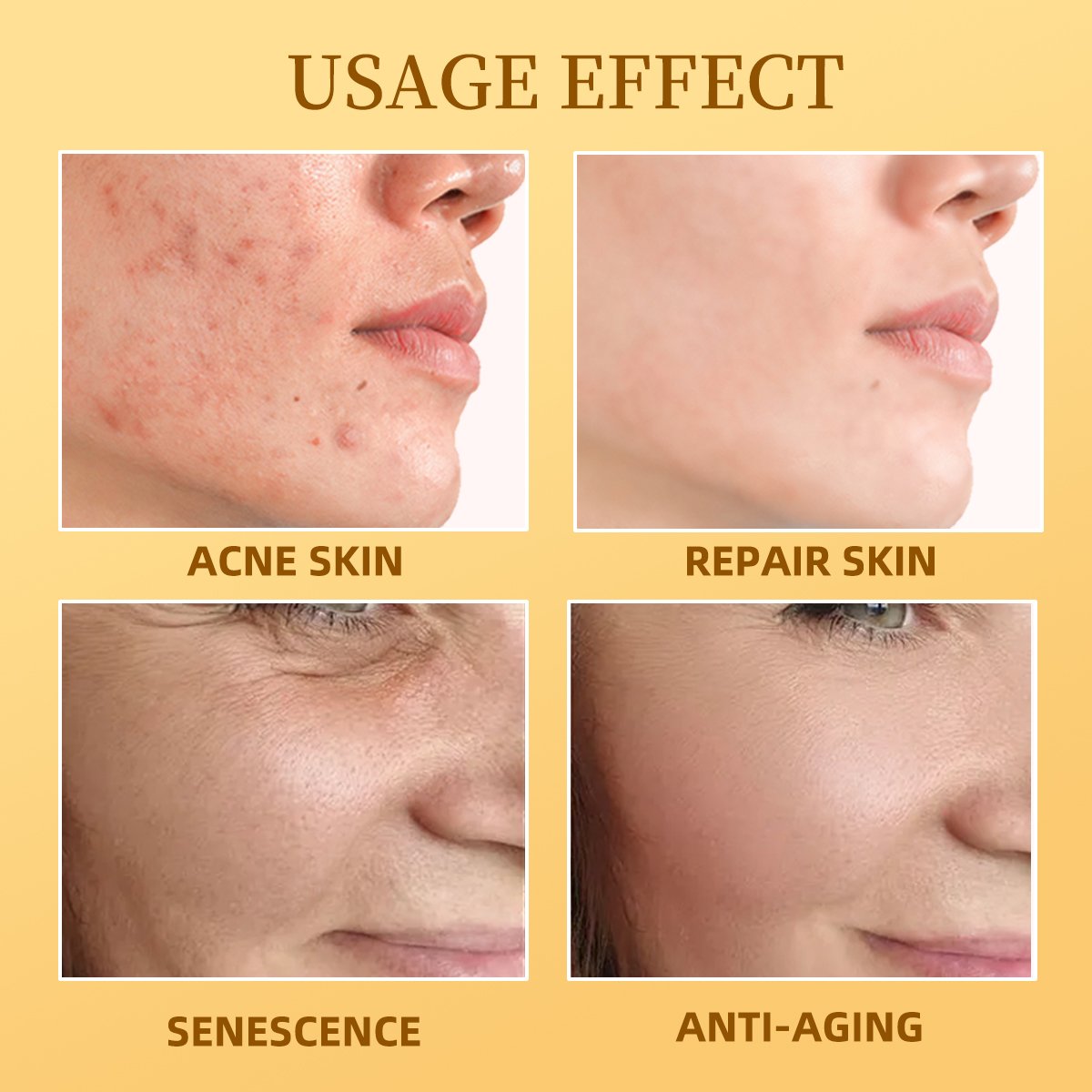 Custom Logo Lightening Brightening Repair Anti Wrinkle Aging Whitening Moisturizing Black Spot Remove Acne Bee Venom Face Cream