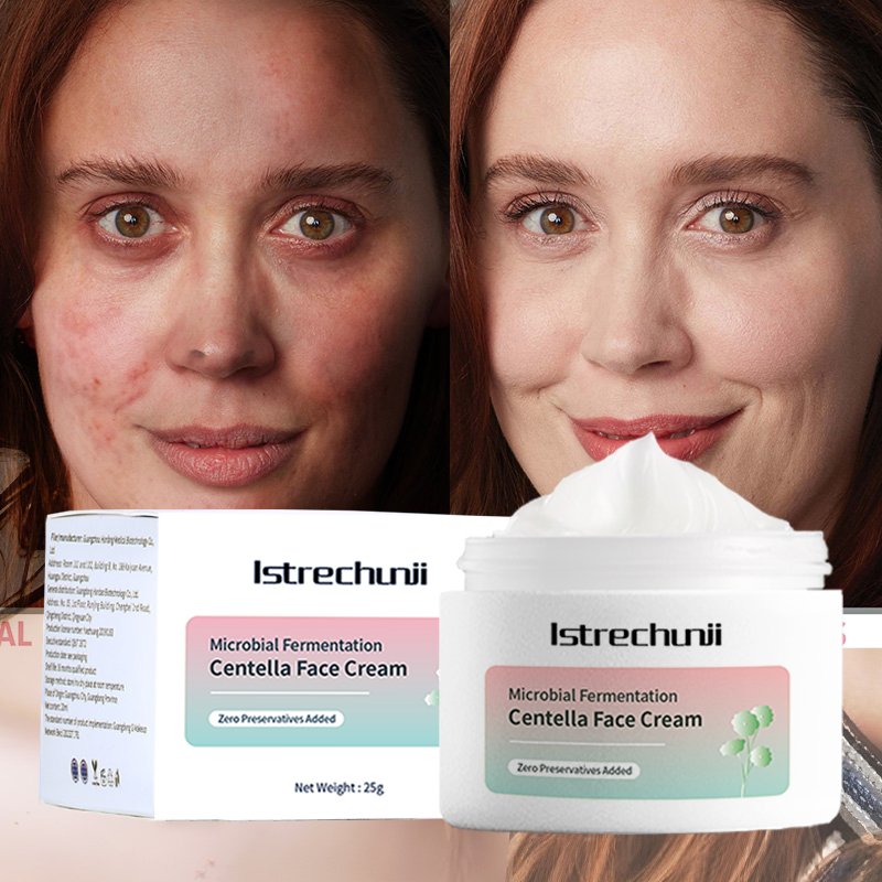 Microbial Fermentation Skincare Improve Skin Irritation Facial Serum Soothing Natural Organic Centella Asiatica Face Cream