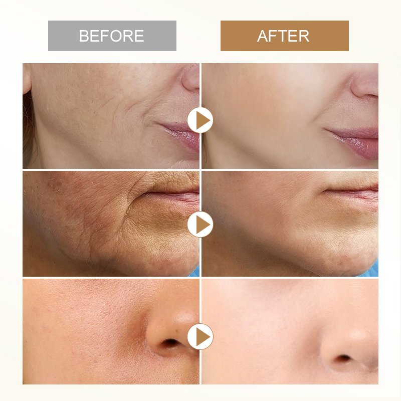 Custom logo bakuchiol anti warinkle facial cream Private label orgnaic Moisturizing Wrinkle Remover Whitening Face Cream