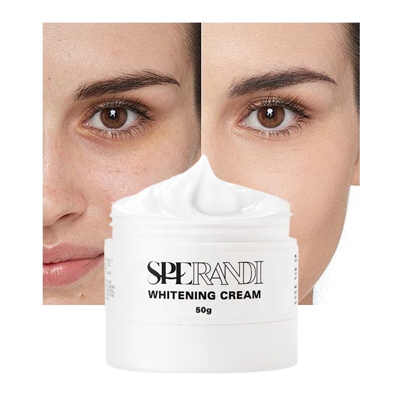 Best Natural Herbal Freckle Remove Day And Night Dark Spot Whitening Face Cream & Lotion (New) For Face Oily Skin