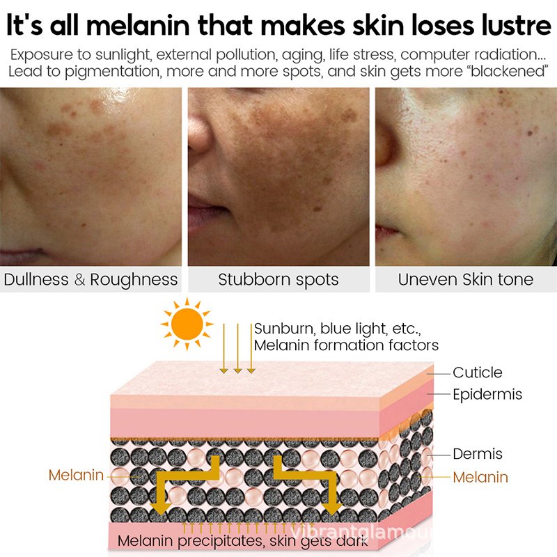 private label face cream whitening moisturizer anti aging acne vitamin c black spot remover face cream