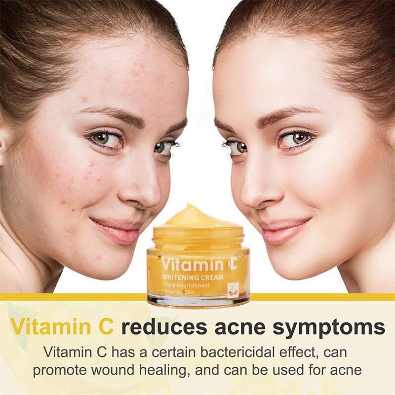 private label face cream whitening moisturizer anti aging acne vitamin c black spot remover face cream