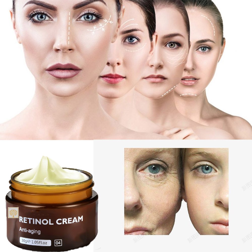Wholesale Retinol Face Cream Kojic Acid Anti-Aging Wrinkle Beauty Dark Spot Removing Acne Skin Whitening Lightening Properties