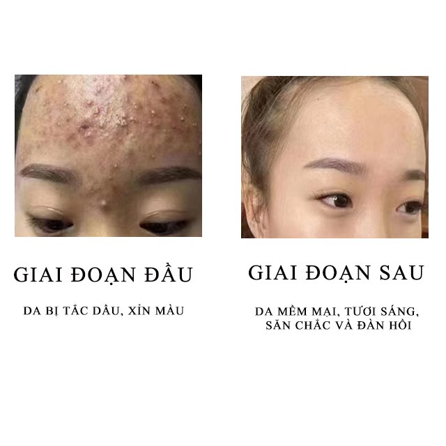 Face Cream Skin Anti Aging Anti Wrinkle Moisturizing Men Cream Face Whitening Night Cream For Man Filled By The Buyer Himself