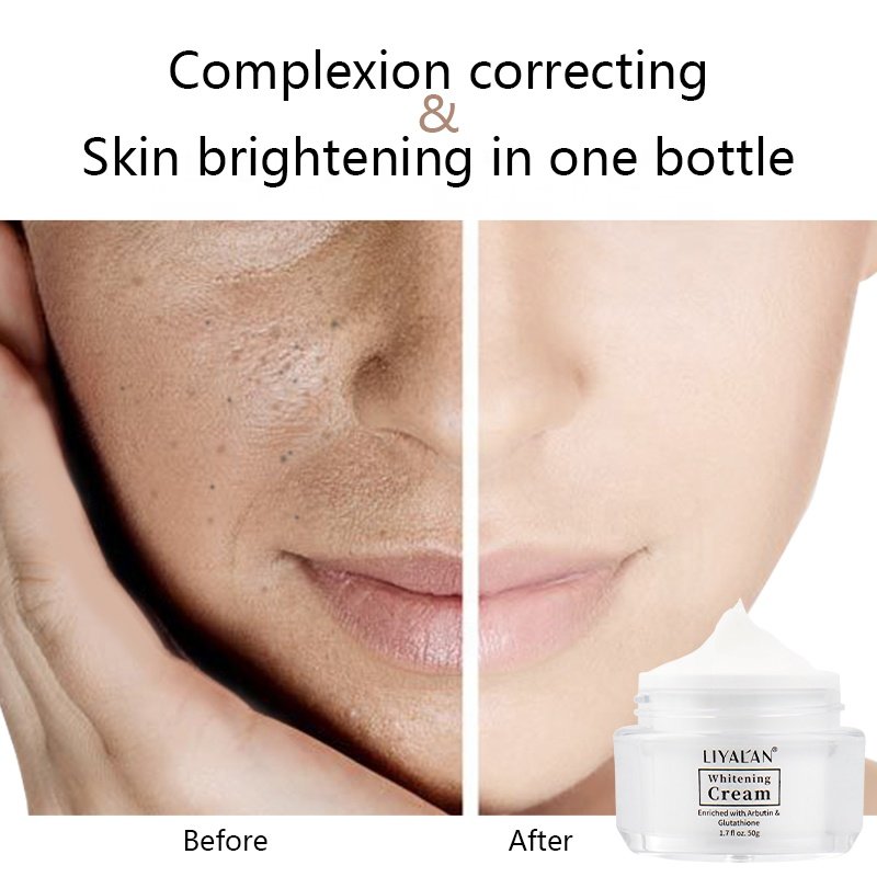 Private Label Lighten Dark Spots Nicotinamide Skin Brightening Arbutin Kojic Acid Whitening Face Cream
