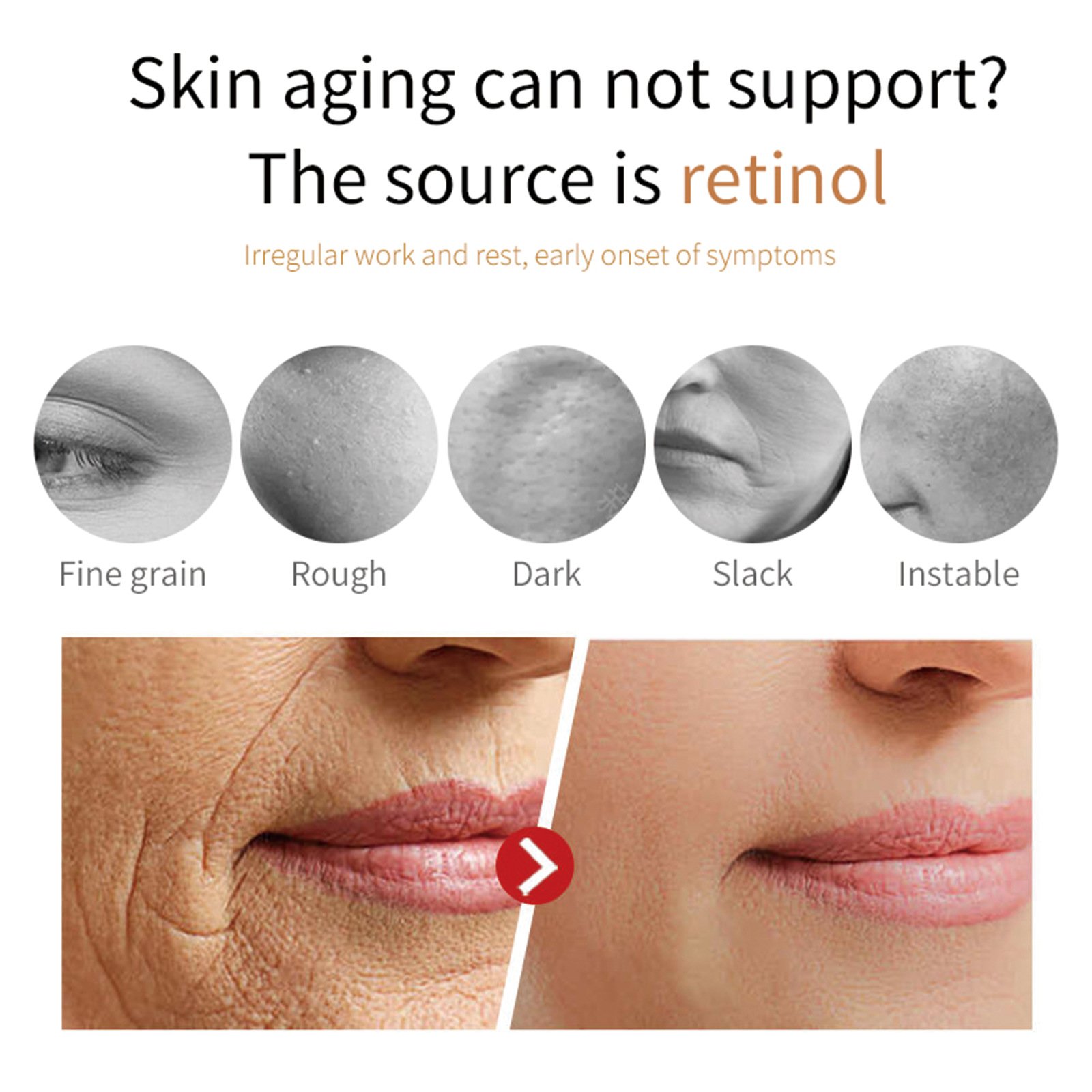 Microbial Ferment Skin Care,tremella Damaged Swelling Acne Skin Removal,whitening Anti Age Wrinkle Collagen Repairing Face Cream