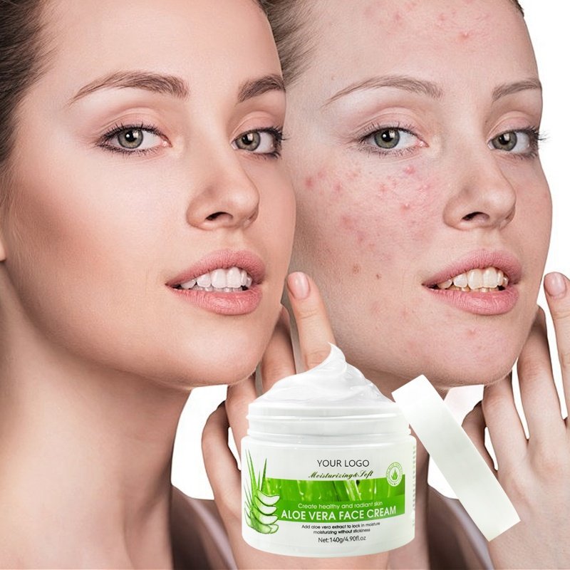 Korea Care Extract Facial Moist Repair Skin Face Cream Aloe Vera Series Customized Moisturizing Aloe Vera Hyaluronic Acid Cream