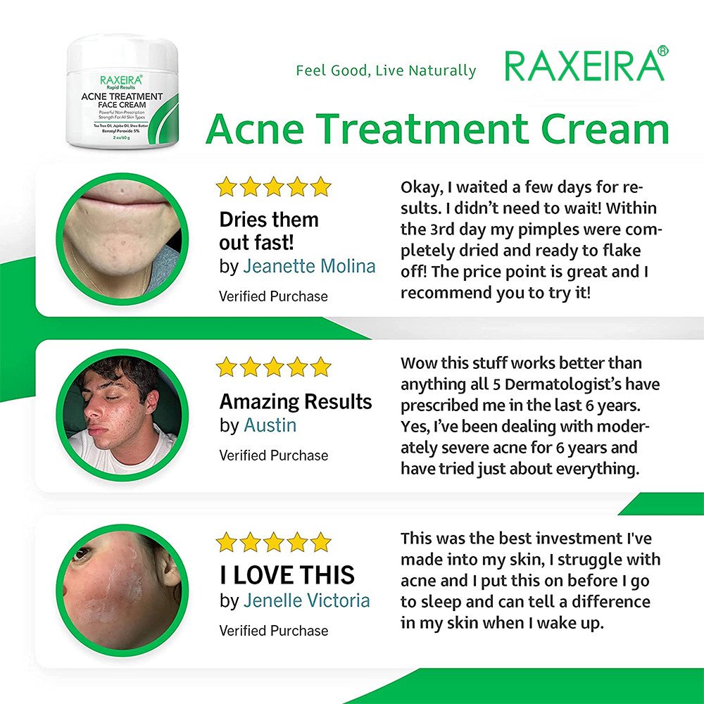 Best Wholesale Herbal Acne Cream Face Care Repair Smooth Skin Shrink Pores Anti Age Acne Treatment Cream For Face Beauty