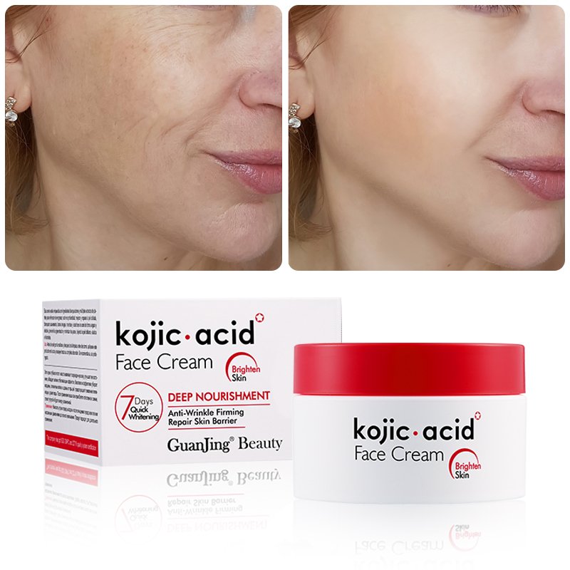 GuanJing moisturizing kojic acid face cream skin whitening cream for dark black skin