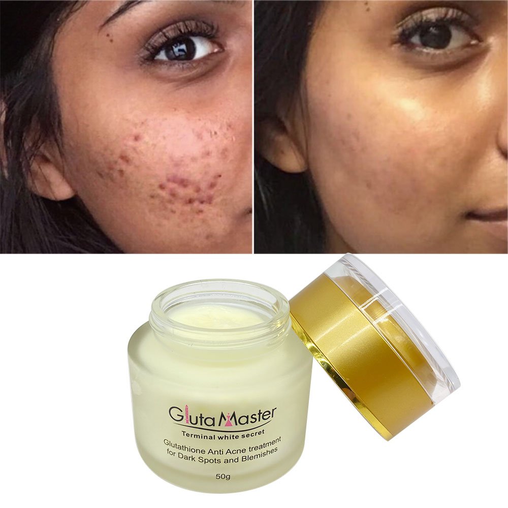 Gluta Master Natural Whitening Anti Acne Treatment Face Cream with Glutathio Removal Pigmentation for Dark Spots and Blemishes