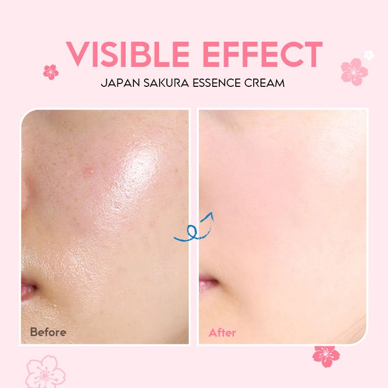 Firming & Nourishing Skin Moisturizing Face Cream & Lotion Cherry Blossom Essence Cream