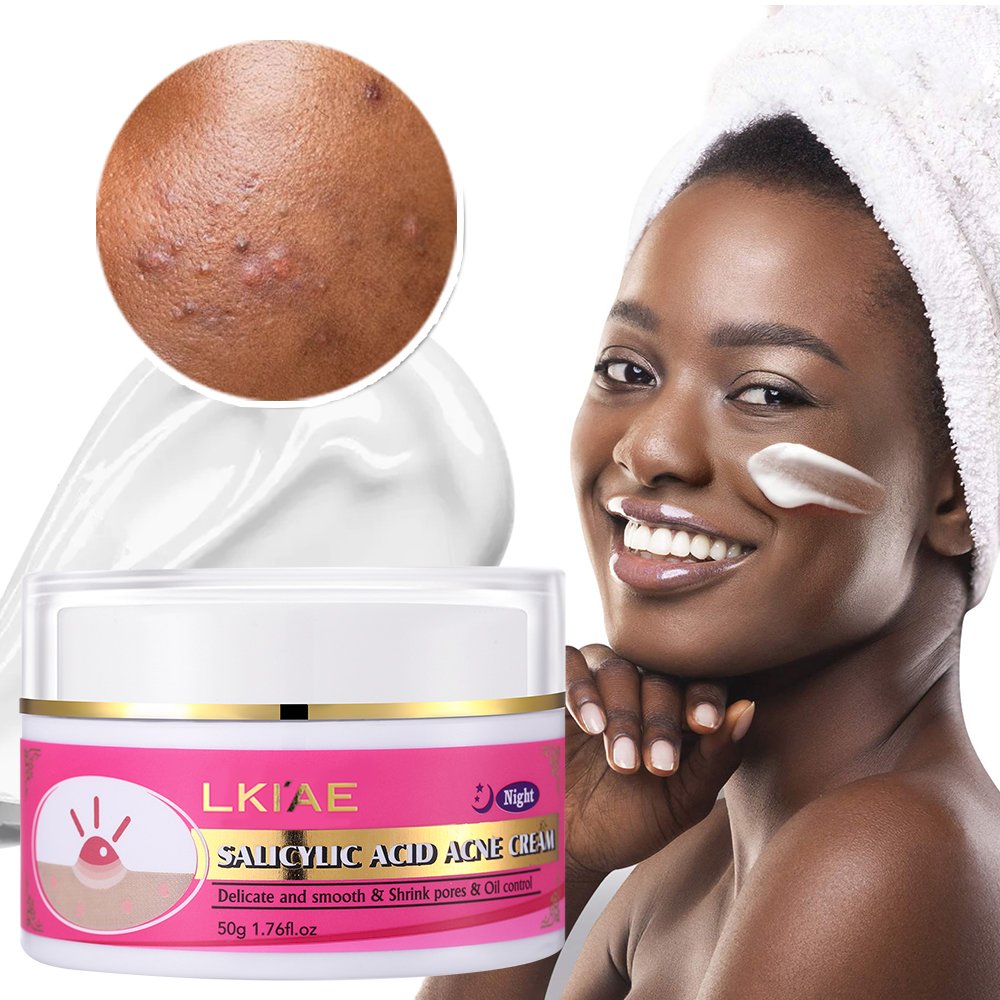 Shrink Pores Anti Acne Cream Retinol Salicylic Acid Pimples Acne Scar Removal Delicate Texture Face Cream