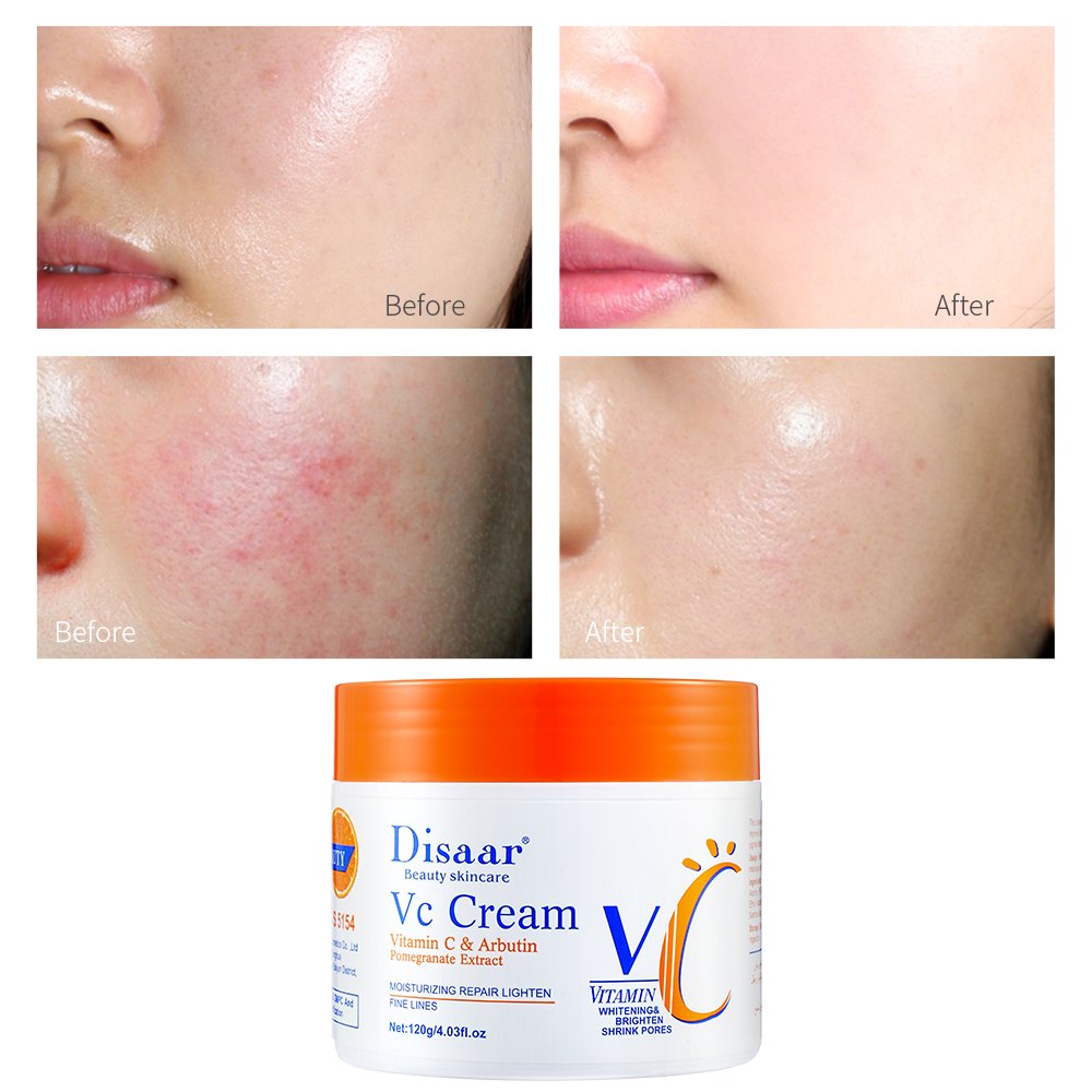 Disaar Vitamin C Skin Whitening Moisturizer Face Cream Day And Night Facial Cream For Skin Brighten Moisture
