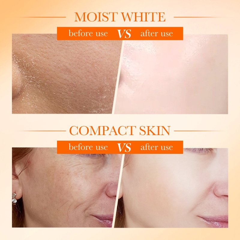 HEAVEN DOVE 120g Organic Vitamin C Bleaching Lightening Face Whitening Cream Whitening Face Cream For Black Skin