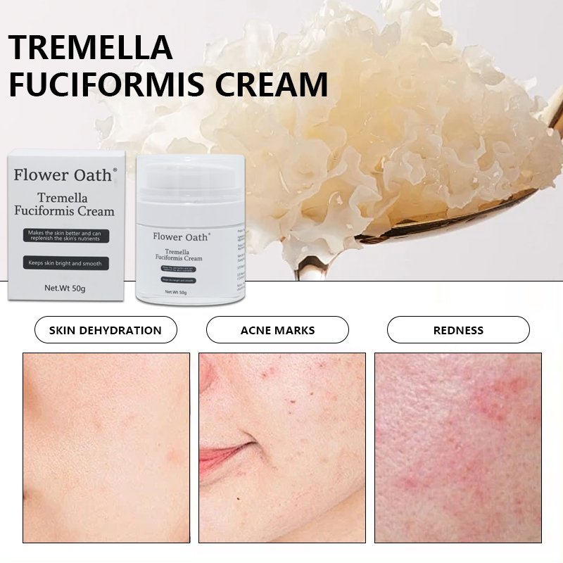 Fresh and Top 10 Dark Spot Removing Face Cream with Nano Technology and Acne D Tremella wrinkle removal face cream