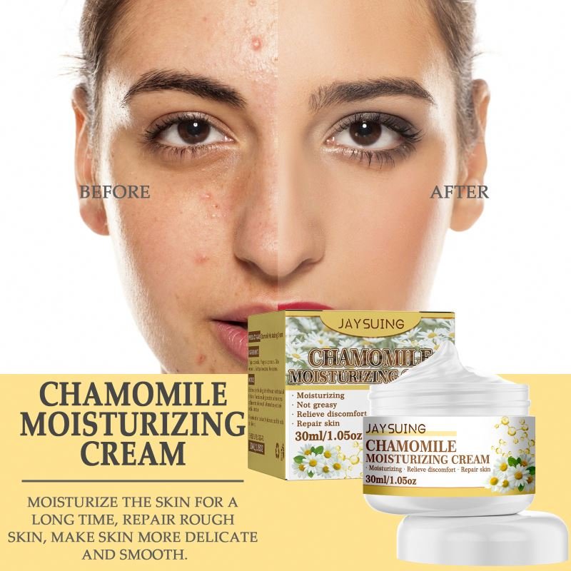 Jaysuing Herbacin Moisturizing Face Cream Hydrating And Brightening Repair Acne Smallpox Diluting Skin face Cream & Lotion