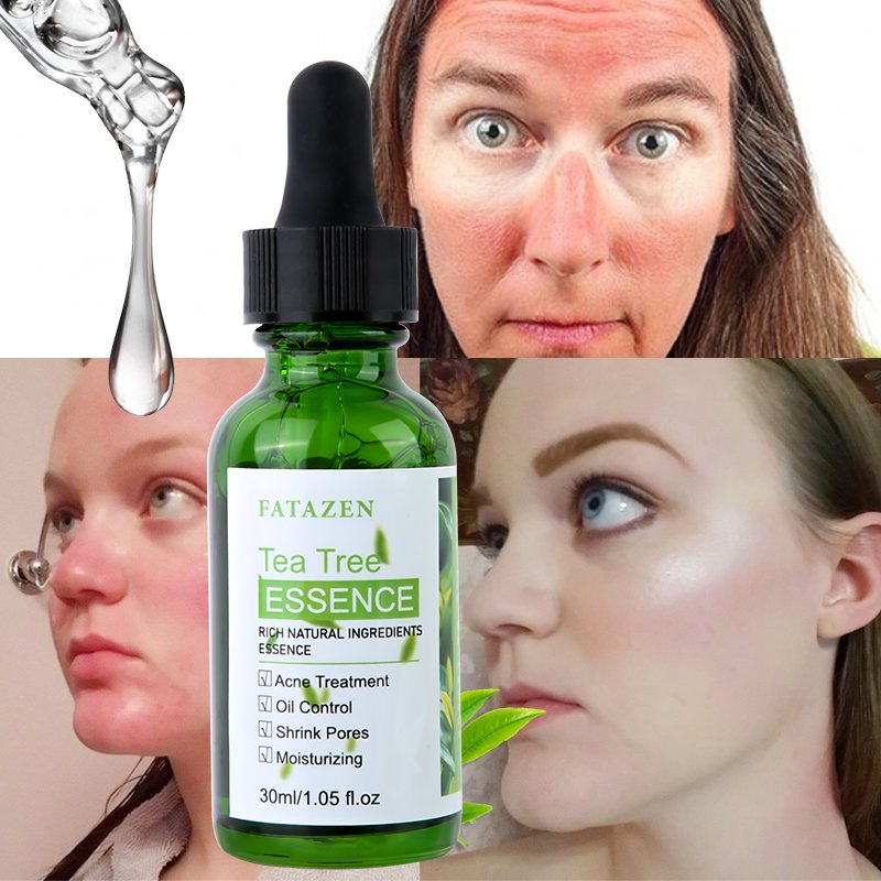 Beauty Products Face Care Brightening Green Tea Anti-acne Serum OEM ODM Hydrating Skincare Tea Tree Facial Serum
