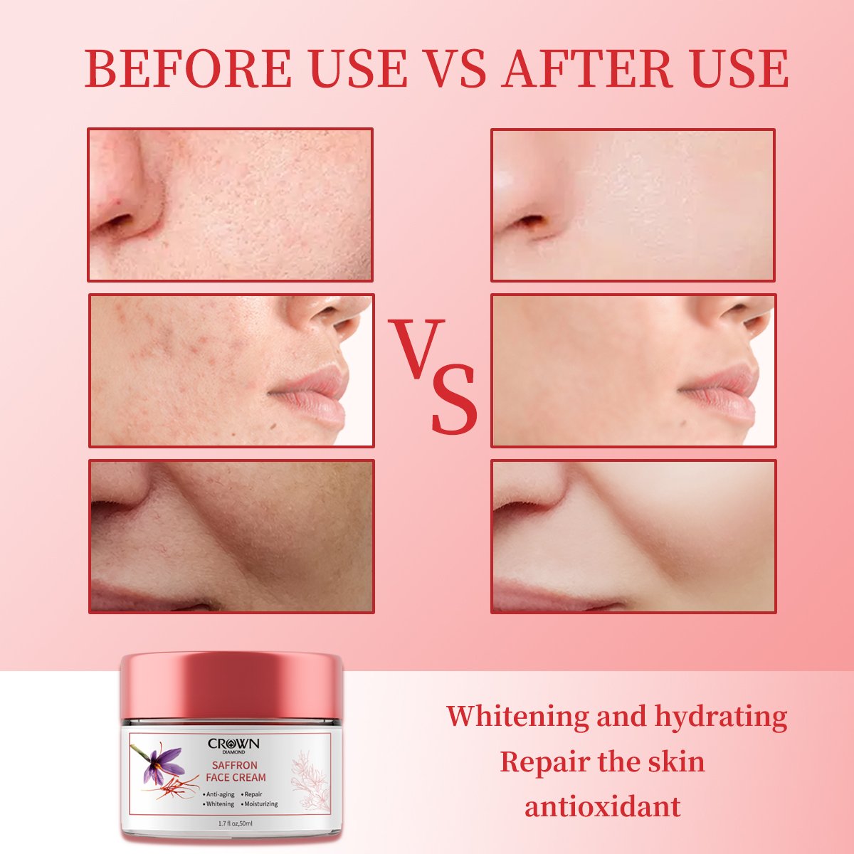 Custom Natural Organic Saffron Removal Melasma Dark Spot Pigment Whitening Moisturizing Firming Repair Anti Aging Face Cream