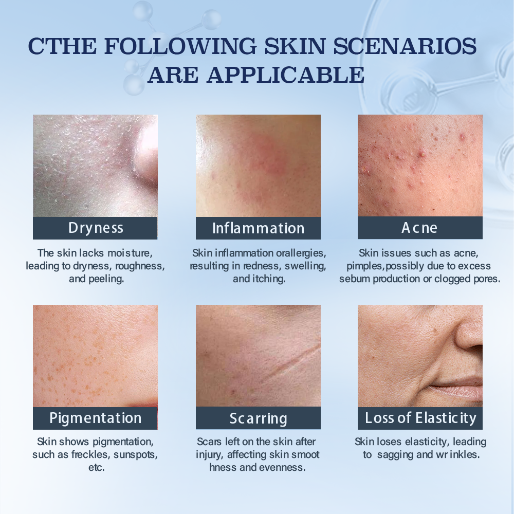 Skin Care Products Anti Aging Collagen Face Cream Acne Pimples Remove Moisturizer Damaged Repair Skin Facial Cream