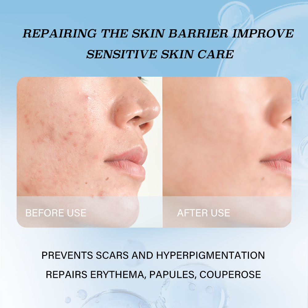 Skin Care Products Anti Aging Collagen Face Cream Acne Pimples Remove Moisturizer Damaged Repair Skin Facial Cream