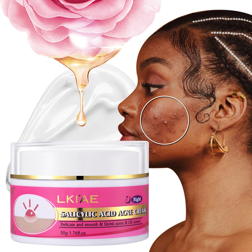 New Arrival Skin Care Organic Acne Treatment Scar Acne Mark Removal Pimple Blackhead Removal Salicylic Acid Face Cream