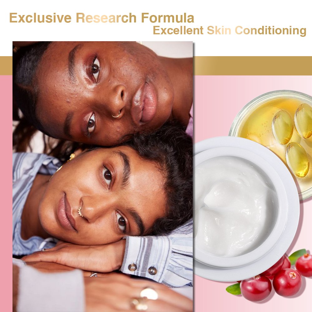 New Arrival Skin Care Organic Acne Treatment Scar Acne Mark Removal Pimple Blackhead Removal Salicylic Acid Face Cream