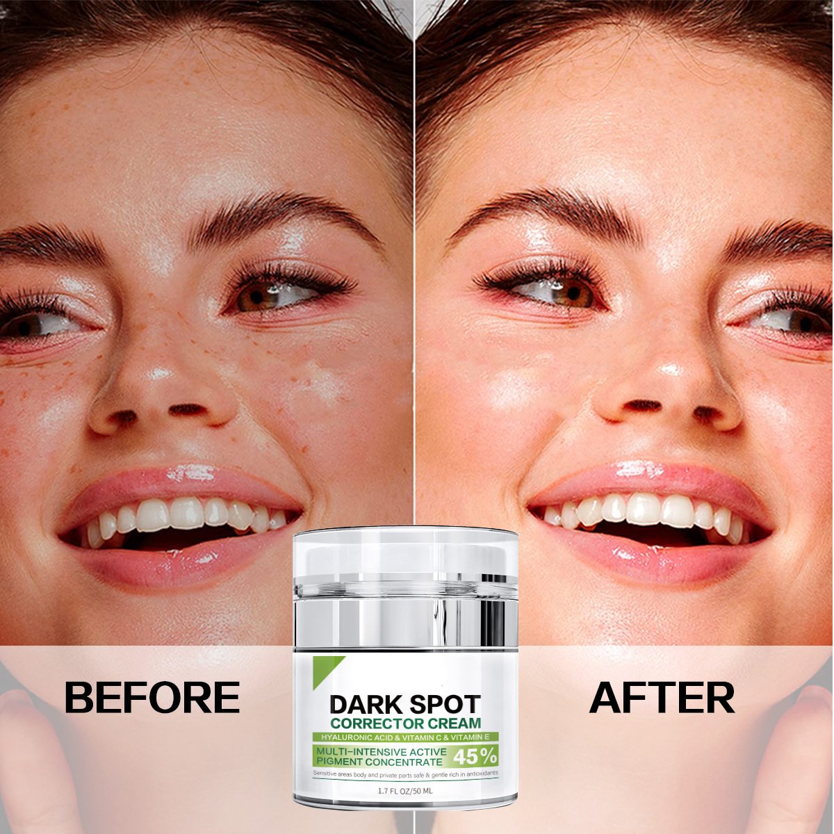 Private Label Hyperpigmentation Treatment Brightening Age Dark Spot Remover Removal Cream For Glowing Skin