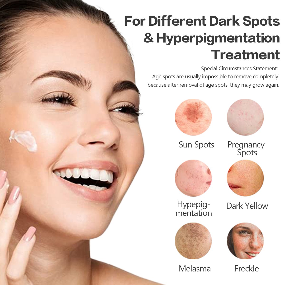 Private Label Hyperpigmentation Treatment Brightening Age Dark Spot Remover Removal Cream For Glowing Skin