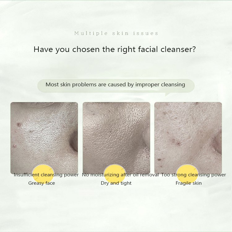 Private Label Amino Acid Face Cleanser Natural Exfoliating Deep Cleansing Two in One Oil Control Foaming Face Wash