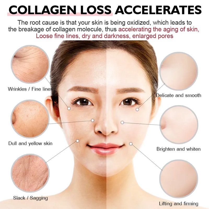 Oem Moisturizing Face Anti Aging Vc Custom Blemish Sleeping Mask Face Wrinkles Facial Cream In China