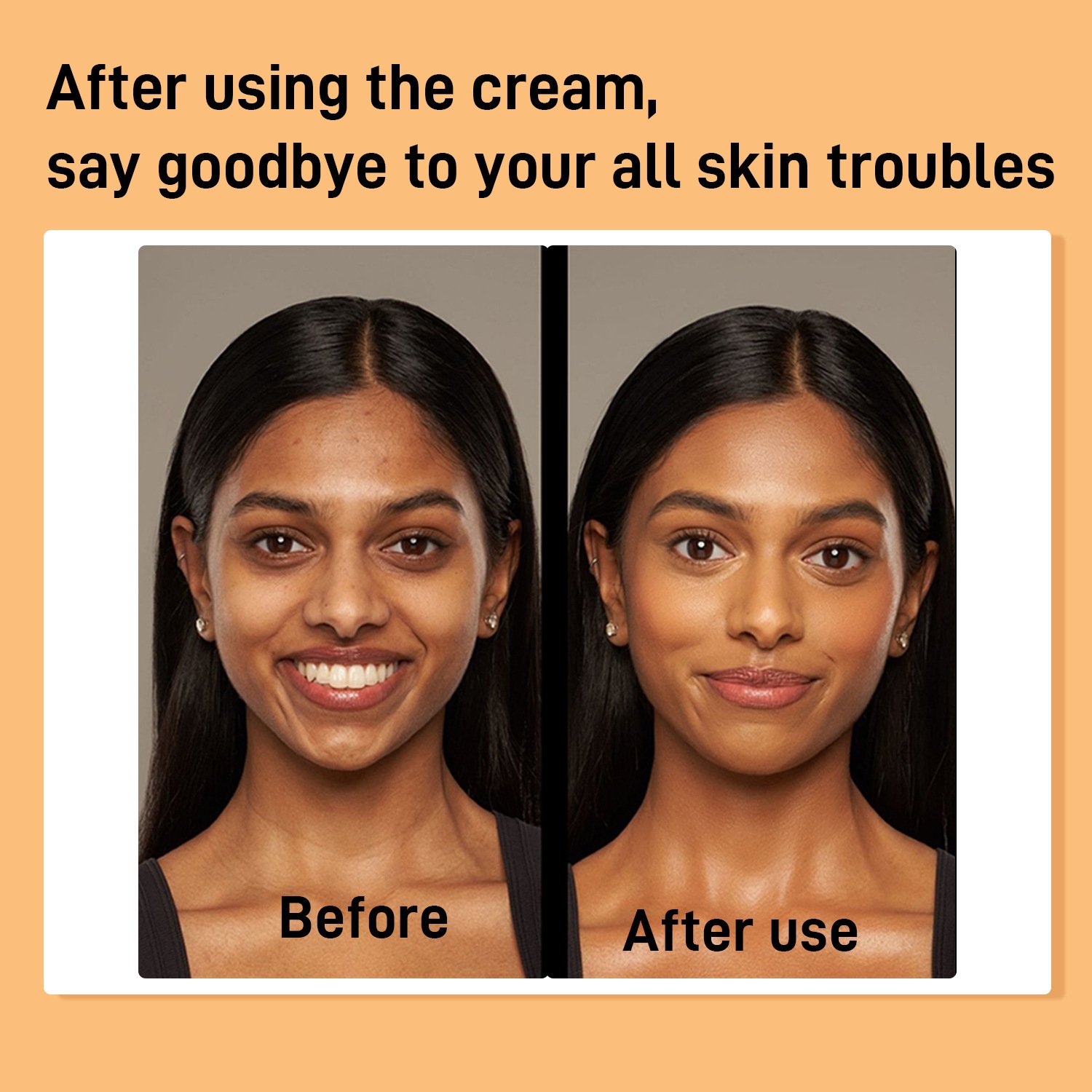 Turmeric and kojic acid face cream to lighten dull and brighten skin face cream