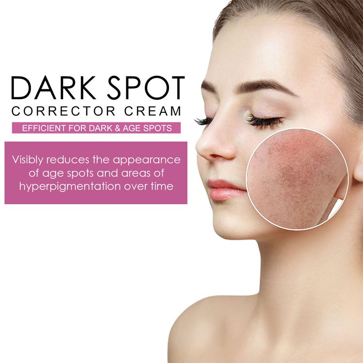 Custom Logo Moisturizing Brightening Skin Refreshing Concealer Freckle Removing Whitening Dark Spot Corrector Face Cream