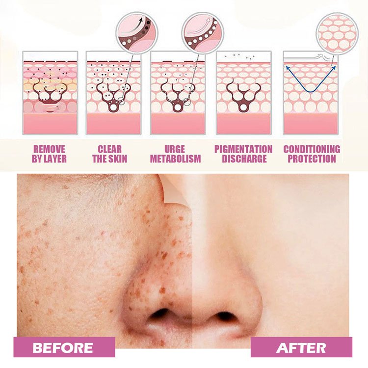 Custom Logo Moisturizing Brightening Skin Refreshing Concealer Freckle Removing Whitening Dark Spot Corrector Face Cream