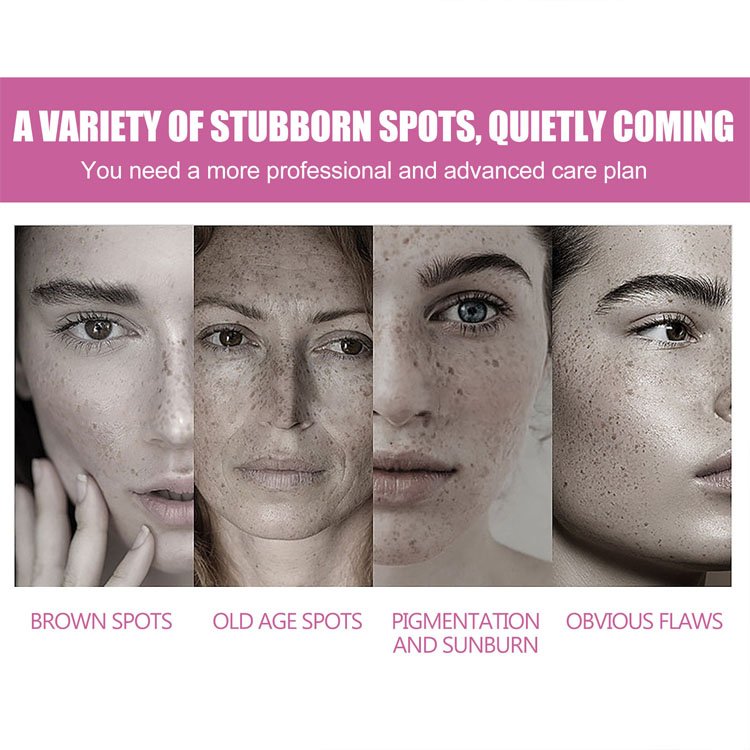 Custom Logo Moisturizing Brightening Skin Refreshing Concealer Freckle Removing Whitening Dark Spot Corrector Face Cream