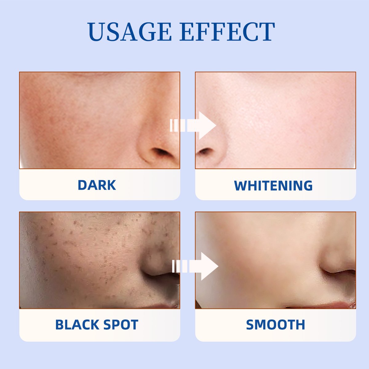 Private Label Intense Brightening Kojic Acid Lightening Moisturizing Removal Pigment Dark Spot Glutathione Whitening Face Cream