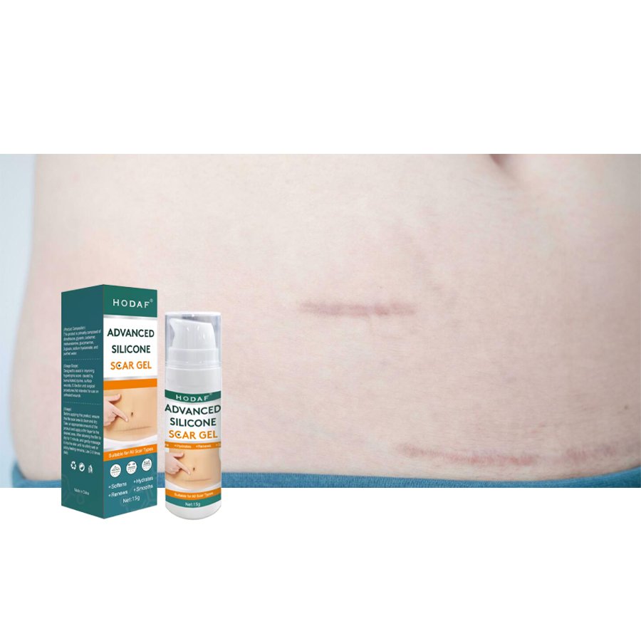 OEM ODM Skin Repair Strong Effective Surgical Burn Dark Scar Removal Cream Natural Keloid Acne Scar Removal Face Cream Gel