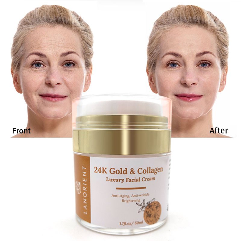 Private Label 24k Gold Whiting Moisturizer Anti Aging Cream For Face Black Spot Remover Moisturizer Face Cream
